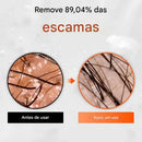 Ampola Antiqueda Capilar com Exossomo Lilyeve Grow:Turn 100ml Tratamento para Queda e Cuidado dos Fios